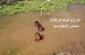 مرض البلهارسيا مرض البلهارسيا