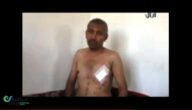 رجل يمني يعود للحياة بعد 4 اطلاقات اخترقة جسده في عملية الإعدام بالرصاص فيديو صور