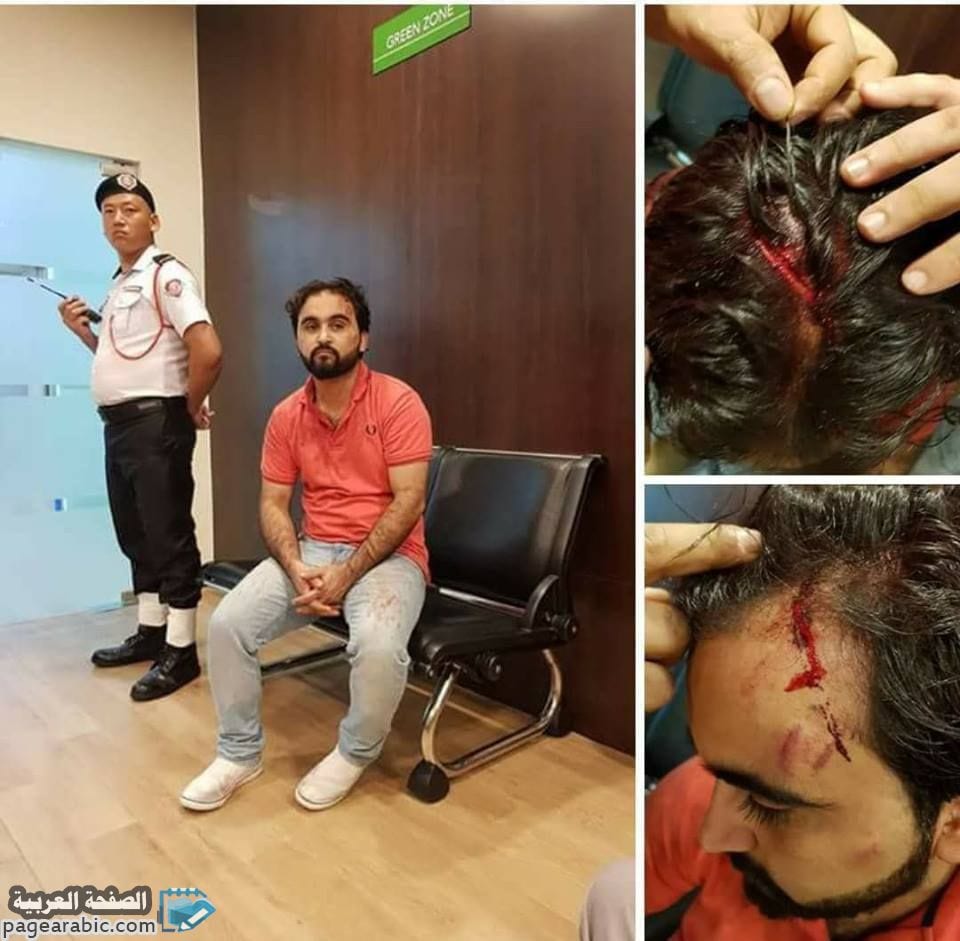 ضرب محمد المسمري في ماليزيا ومحاولة إغتياله من قبل هنود