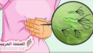 علاج جرثومة المعدة (الملوية البوابية)